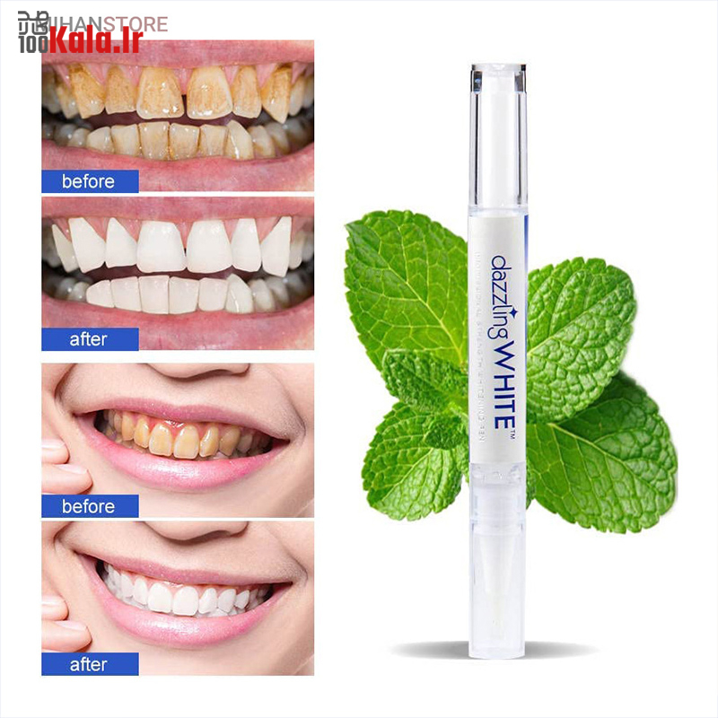 قلم سفید کننده دندان Dazzling White 23 d982d984d985 d8b3d981db8cd8af daa9d986d986d8afd987 d8afd986d8afd8a7d986 dazzling white 68dfba3d8ad56