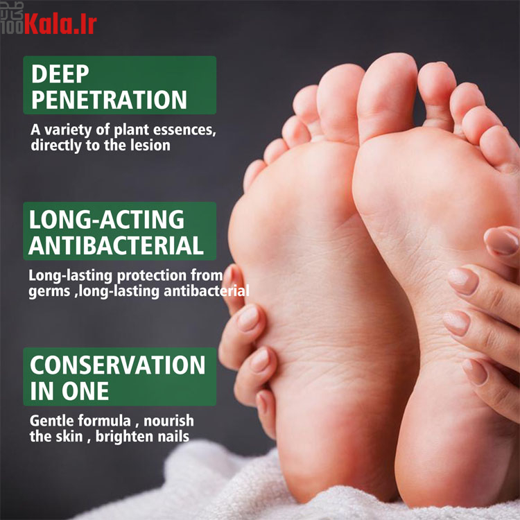 اسپری گیاهی ضد بو و درمان زخم پا حجم 30 میلی لیتر 3 اسپری گیاهی ضد بو و درمان زخم پا حجم 30 میلی لیتر - Image 3