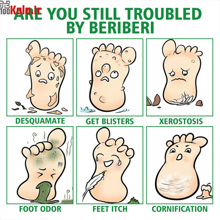 اسپری گیاهی ضد بو و درمان زخم پا حجم 30 میلی لیتر 4 اسپری گیاهی ضد بو و درمان زخم پا حجم 30 میلی لیتر - Image 4