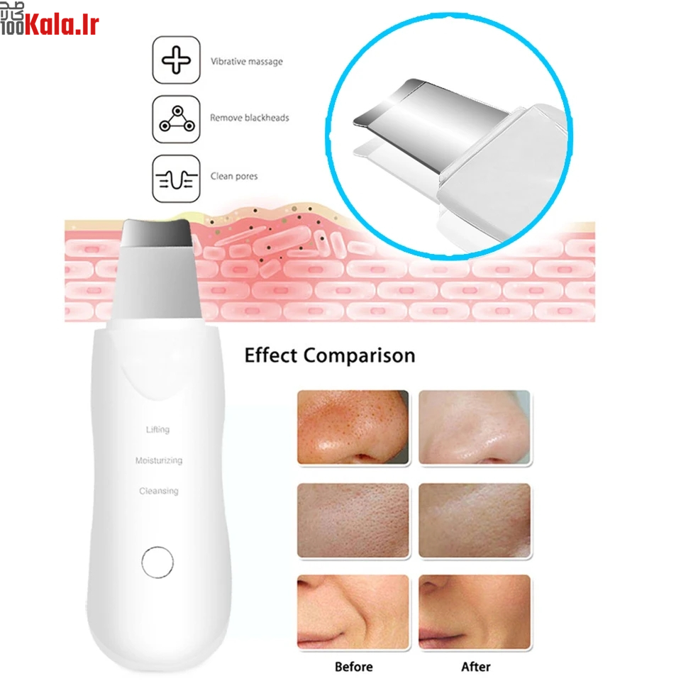 دستگاه اتو صورت التراسونیک 5 دستگاه اتو صورت التراسونیک - Image 5