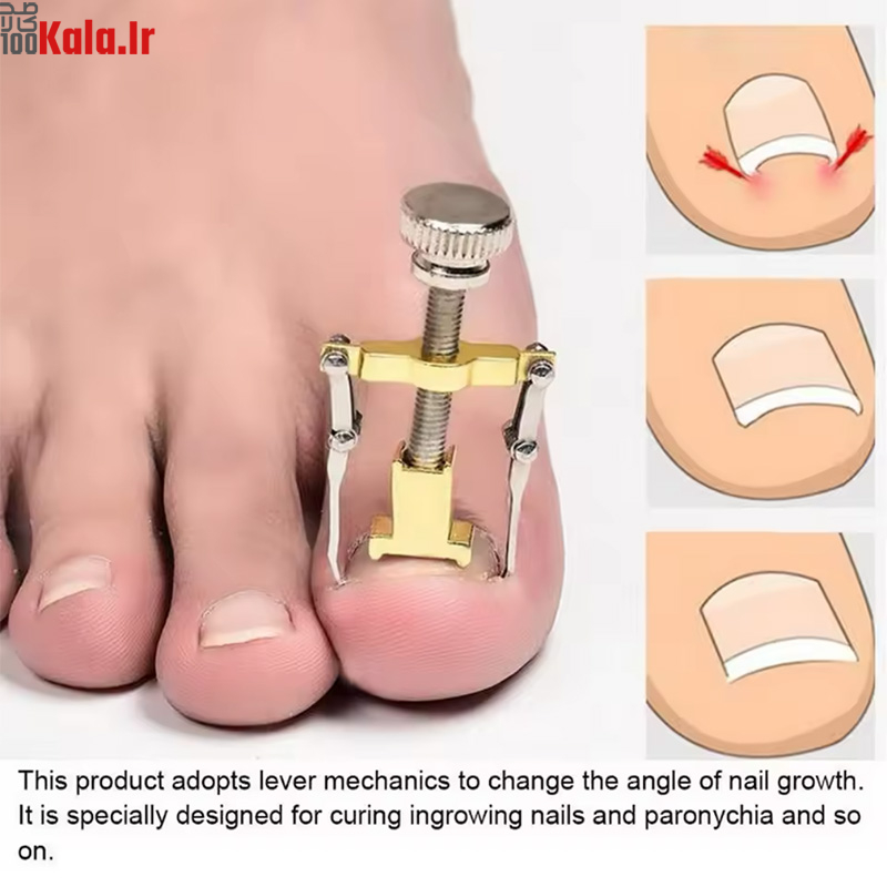 دستگاه اصلاح فرم و ارتودنسی ناخن مدل Nails 2 دستگاه اصلاح فرم و ارتودنسی ناخن مدل Nails - Image 2