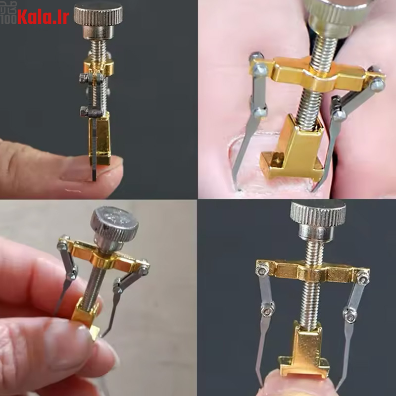 دستگاه اصلاح فرم و ارتودنسی ناخن مدل Nails 5 دستگاه اصلاح فرم و ارتودنسی ناخن مدل Nails - Image 5