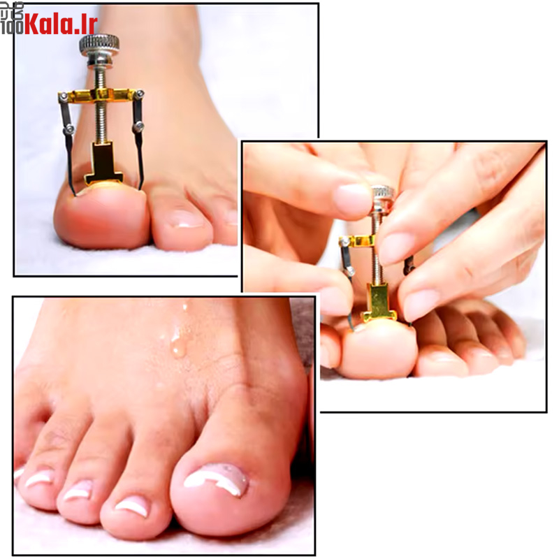 دستگاه اصلاح فرم و ارتودنسی ناخن مدل Nails 6 دستگاه اصلاح فرم و ارتودنسی ناخن مدل Nails - Image 6