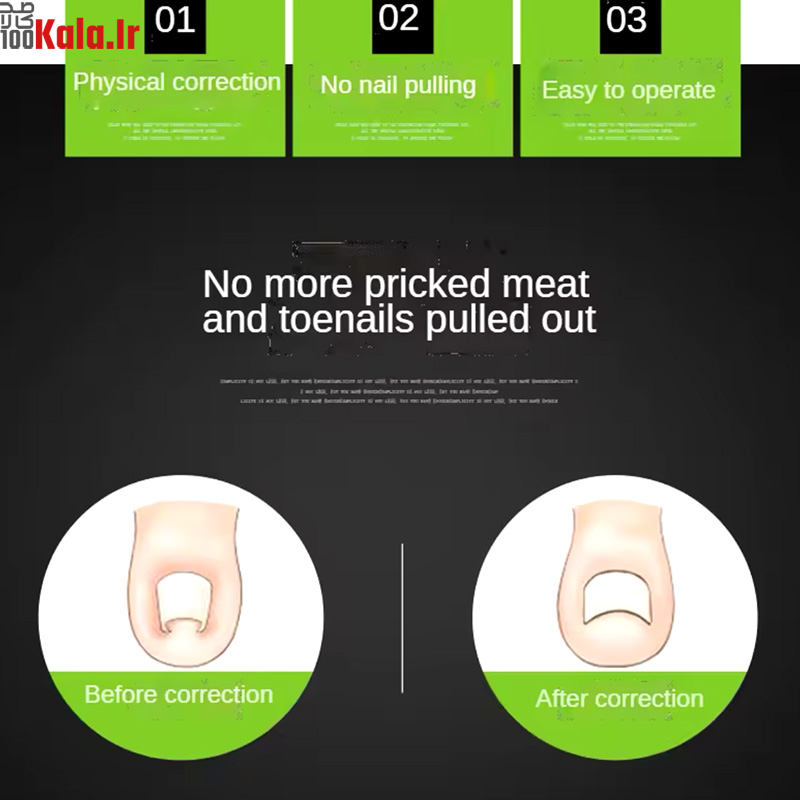 دستگاه اصلاح فرم و ارتودنسی ناخن مدل Nails 8 دستگاه اصلاح فرم و ارتودنسی ناخن مدل Nails - Image 8