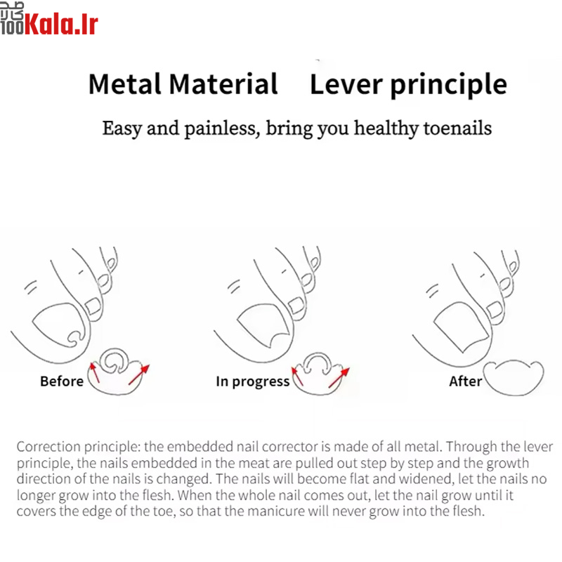 دستگاه اصلاح فرم و ارتودنسی ناخن مدل Nails 9 دستگاه اصلاح فرم و ارتودنسی ناخن مدل Nails - Image 9