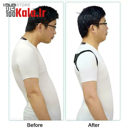 قوزبند رفع افتادگی شانه HANA 7 قوزبند رفع افتادگی شانه HANA - Image 7