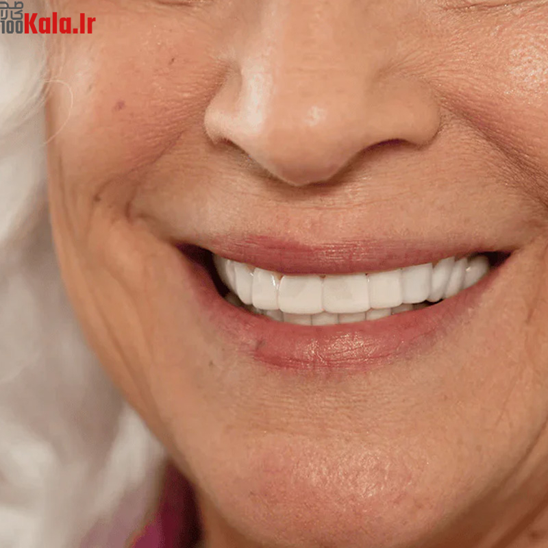 لمینت دندان دو فک مدل TruSmile به همراه نوار چسب سفید کننده دندان 4 لمینت دندان دو فک مدل TruSmile به همراه نوار چسب سفید کننده دندان - Image 4