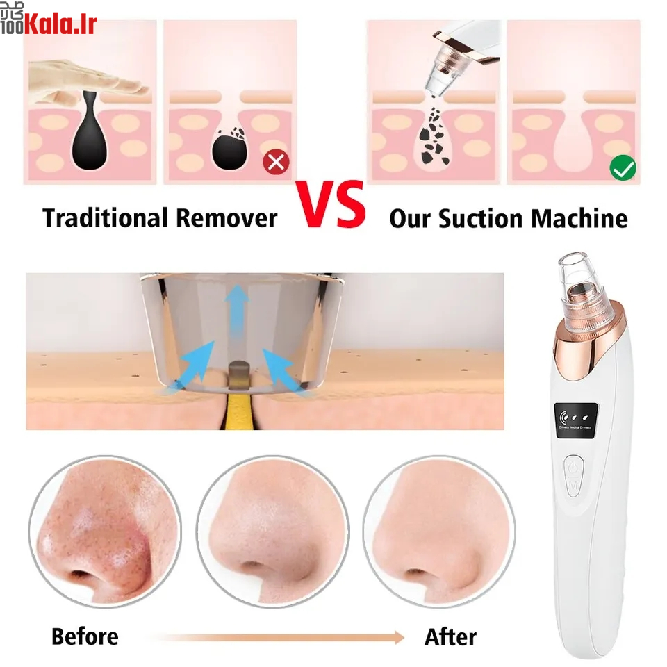 میکرودرم پاک سازی و مراقبت از پوست 2 میکرودرم پاک سازی و مراقبت از پوست - Image 2