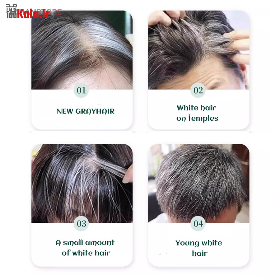 رنگ گیاهی رفع سفیدی مو (شانه دار) 6 رنگ گیاهی رفع سفیدی مو (شانه دار) - Image 6