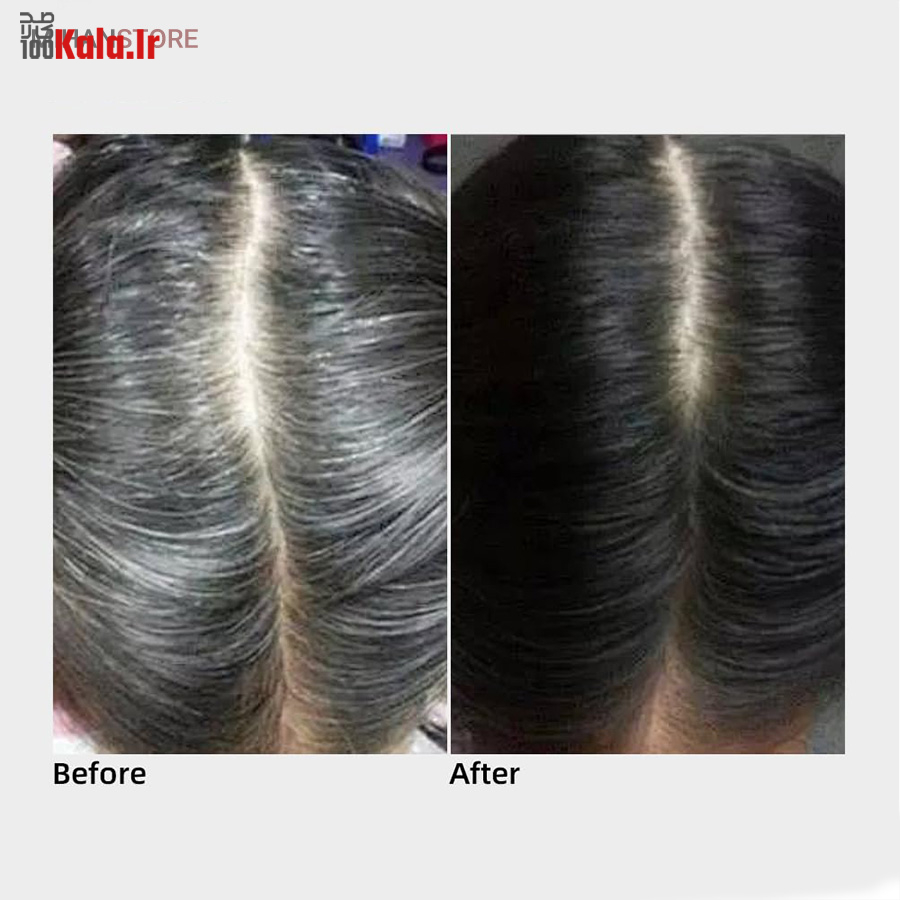 رنگ گیاهی رفع سفیدی مو (شانه دار) 13 رنگ گیاهی رفع سفیدی مو (شانه دار) - Image 13