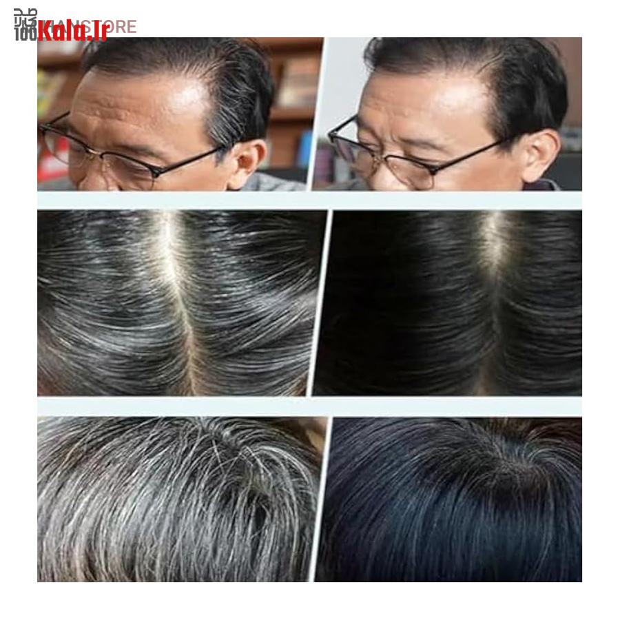 رنگ گیاهی رفع سفیدی مو (شانه دار) 23 رنگ گیاهی رفع سفیدی مو (شانه دار) - Image 23