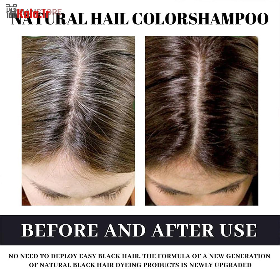 رنگ گیاهی رفع سفیدی مو (شانه دار) 28 رنگ گیاهی رفع سفیدی مو (شانه دار) - Image 28