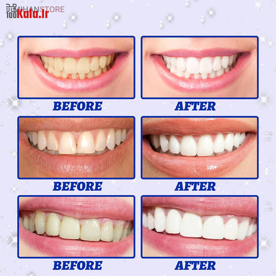 قلم سفید کننده دندان Dazzling White 11 قلم سفید کننده دندان Dazzling White - Image 11
