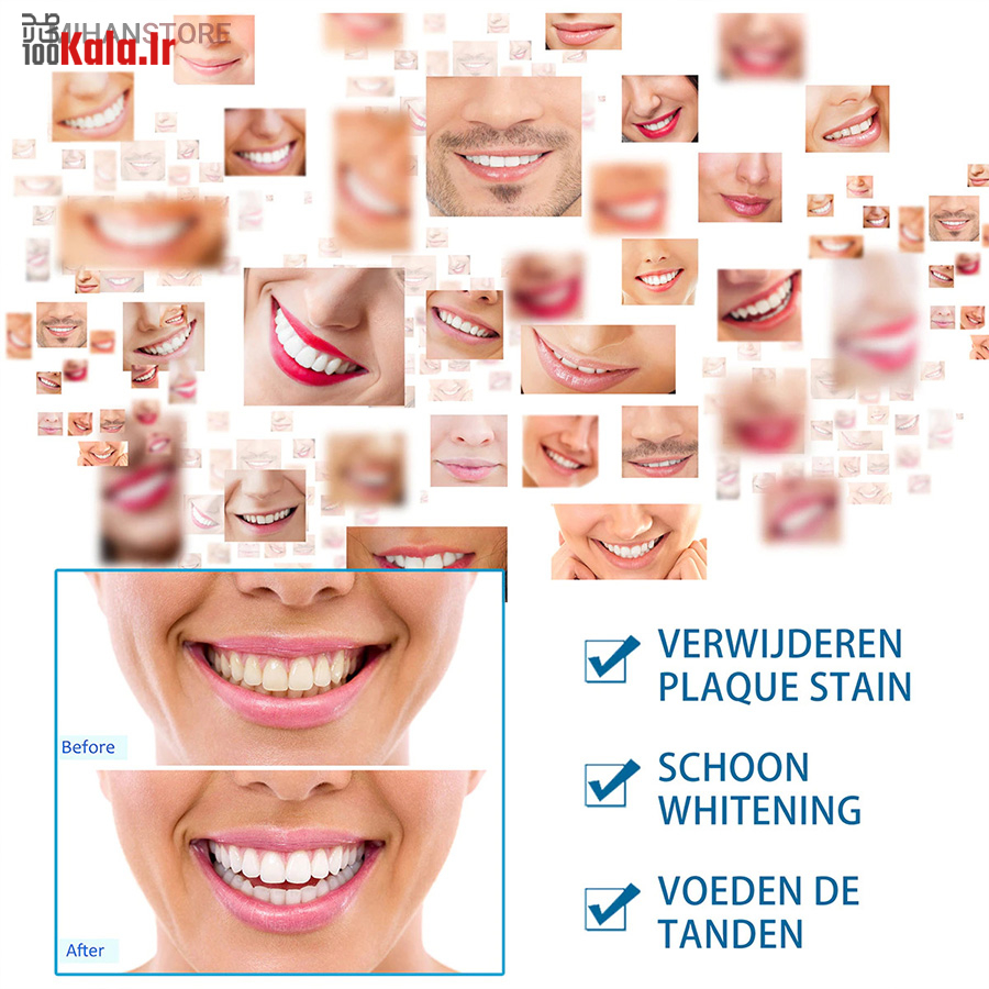 قلم سفید کننده دندان Dazzling White 12 قلم سفید کننده دندان Dazzling White - Image 12